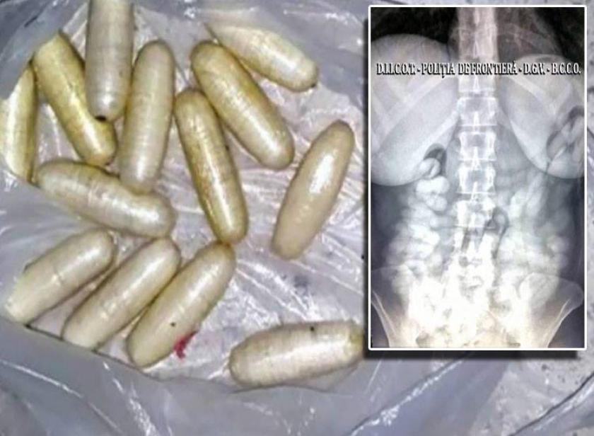 Megdöbbentő dolgot találtak az Otopeni repülőtéren. 2 kiló kokaint rejtett a gyomrába egy férfi és egy nő